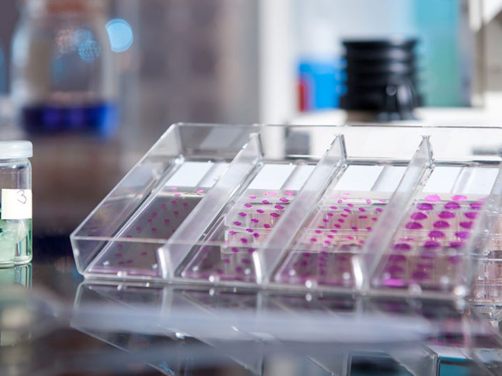Article | Impact of COVID-19 on the In-vitro Diagnostics Industry