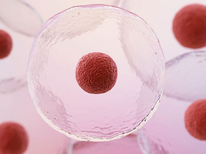 Article | KOLs: Stem Cell Transplantation (SCT) – India